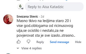 Masno tkivo